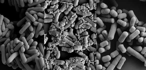 ▲특허 유산균 MPRO3 이미지. 왼쪽부터 - 락토바실러스 카제이 HY2782, 비피도박테리움락티스 HY8002, 락토바실러스 플란타룸 HY7712 ⓒ한국야쿠르트
