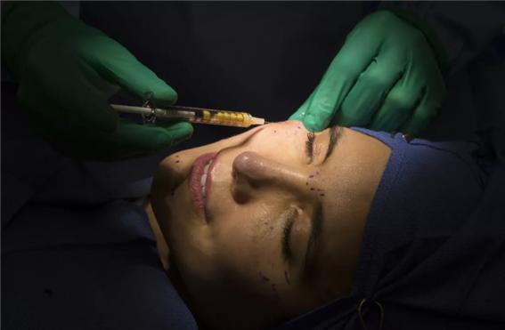 ▲30세 미만의 Z세대가 다른 세대보다 더 많은 성형수술을 예약하고 있다. ⓒLA Times 홈페이지 캡쳐