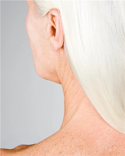 ▲ 목 피부는 신체의 다른 부위보다 더 빨리 노화되는 경향이 있다. Ⓒ NYT 홈페이지 캡쳐