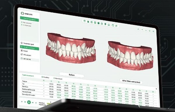 ▲얼라인스튜디오 자료 화면. ⓒ라온메디